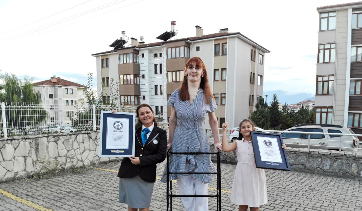 The world's tallest living woman is a 24-year-old from Turkey